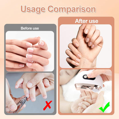 Premium Electric Nail Clipper™